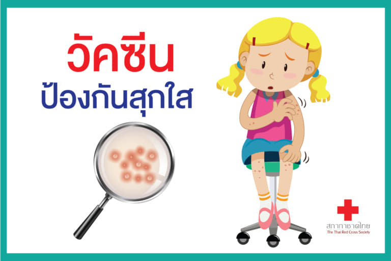 หน้าเปิด – วัคซีนป้องกันสุกใส-01