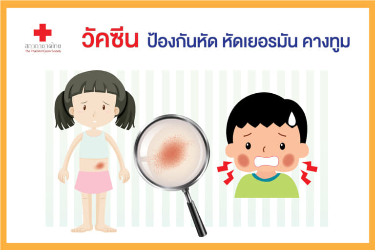 หน้าเปิด – วัคซีนป้องกันหัด หัดเยอรมัน คางท