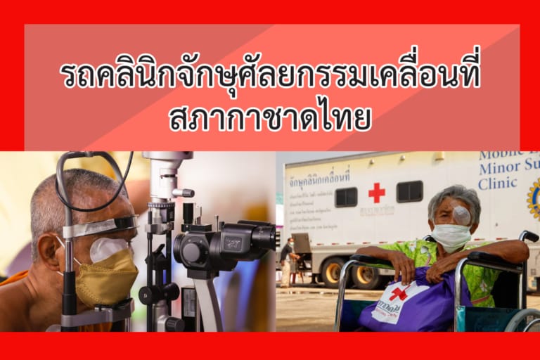 บทความ เรื่อง รถคลินิกจักษุศัลยกรรมเคลื่อ