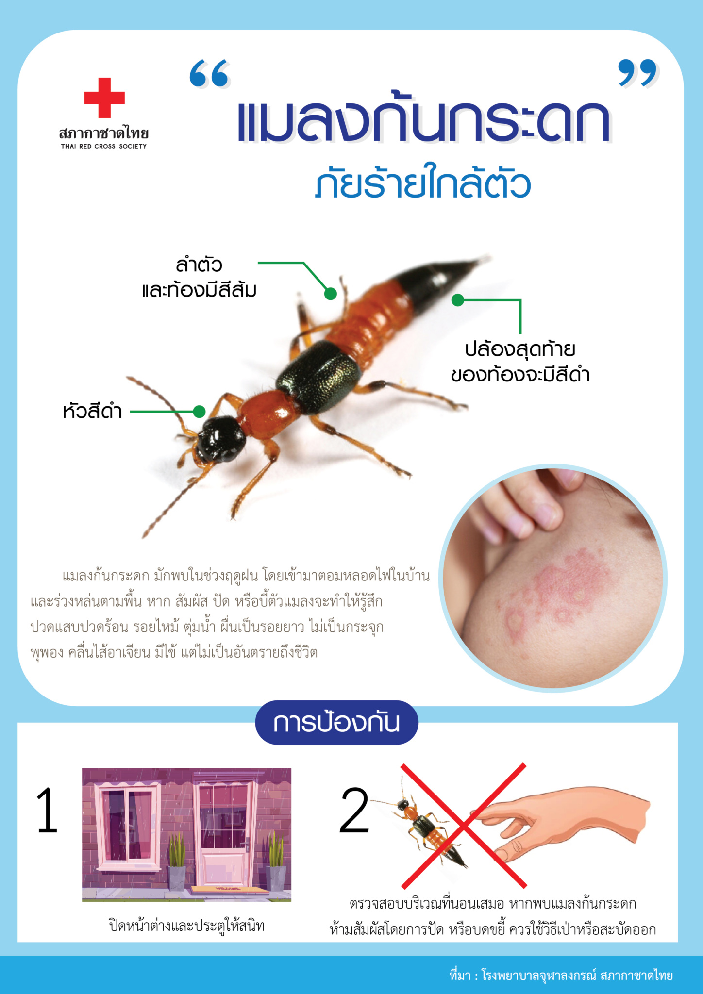 แมลงก้นกระดก ภัยร้ายใกล้ตัว - เว็บไซต์สภากาชาดไทย (ภาษาไทย)