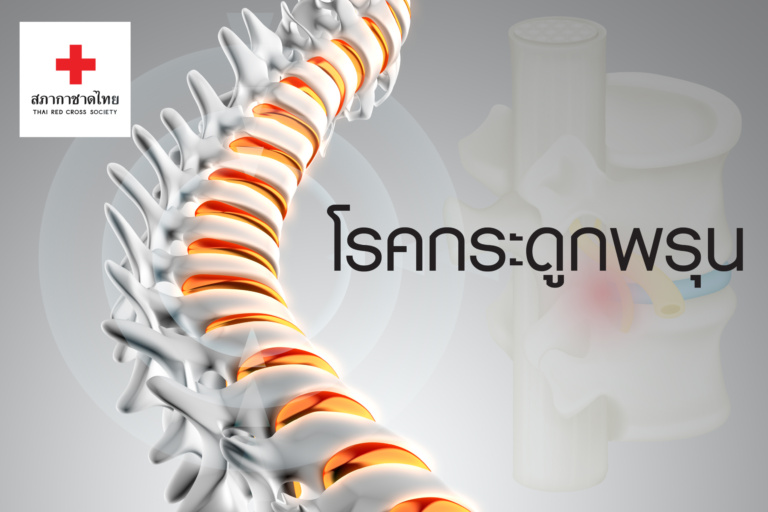 1บทความ เรื่องโรคกระดูกพรุน-01