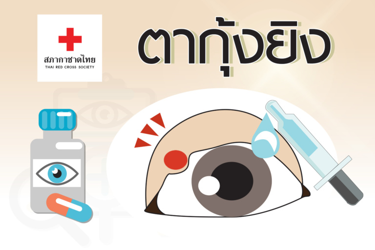 หน้าเปิด – ตากุ้งยิง-01