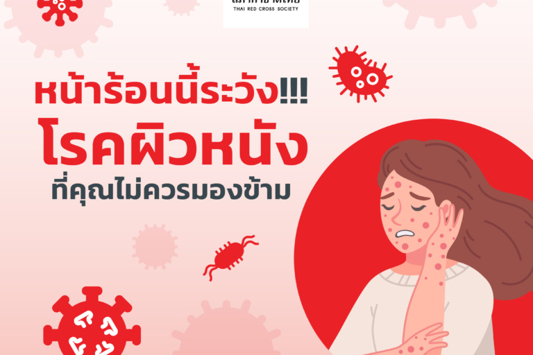 2.ปกบทความ2_เดือนมีนาคม 2568 รูปภาพหน้าร้อนนี้ระวังโรคผิวหนังที่คุณไม่ควรมองข้าม