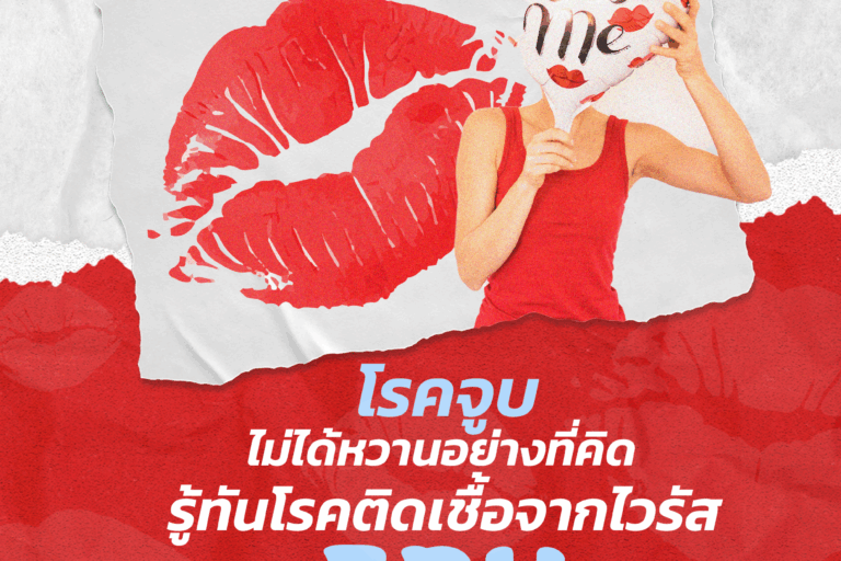 Cover_บทความ 2_เดือนกรกฎาคม 2568 ริมฝีปากจูบสีแดงข้อความแสดงหัวข้อ โรคจูบ